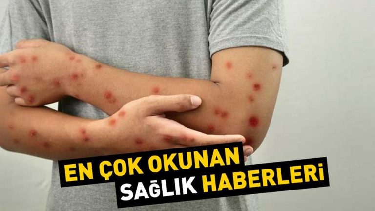 Günün en önemli sağlık haberleri, 16 Ağustos 2024…