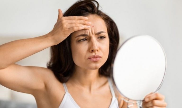 Sivilce yara izlerini hızlı bir şekilde silin: Akne lekeleri için iyi olan 8 doğal yöntem – Son Dakika Yaşam Haberleri