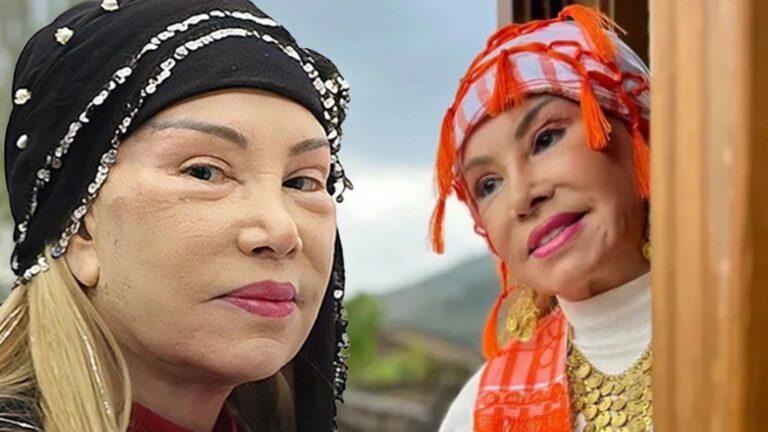 Bedia Akartürk yüzünü gerdirmişti! Son hali ortaya çıktı